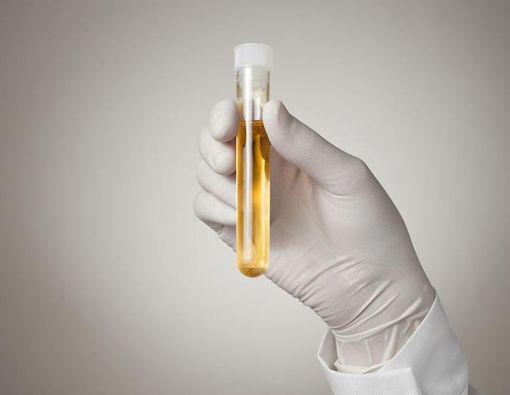 Bahaya di Balik Terapi Urine