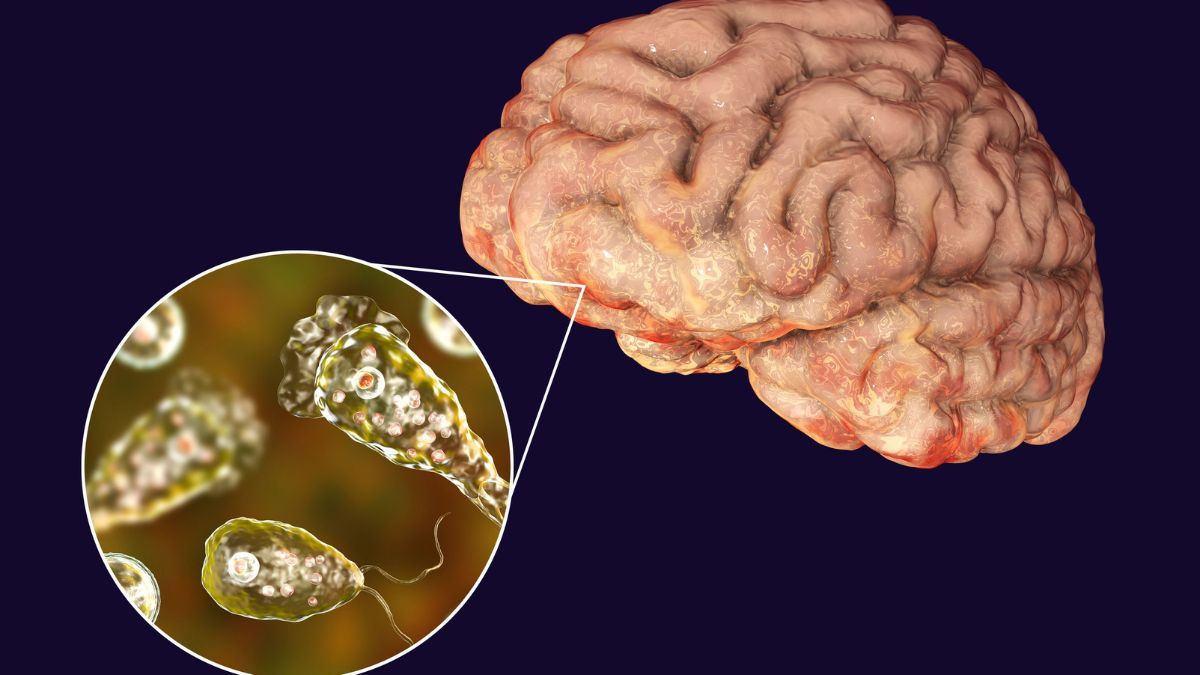 Waspada, Ini 3 Cara Penyebaran Amoeba Pemakan Otak 