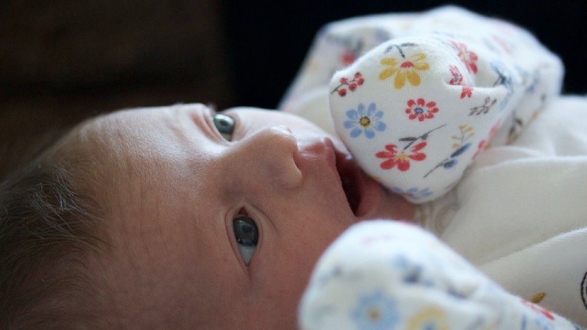 Sindrom CHARGE, Bentuk Mata Bayi seperti Mata Kucing