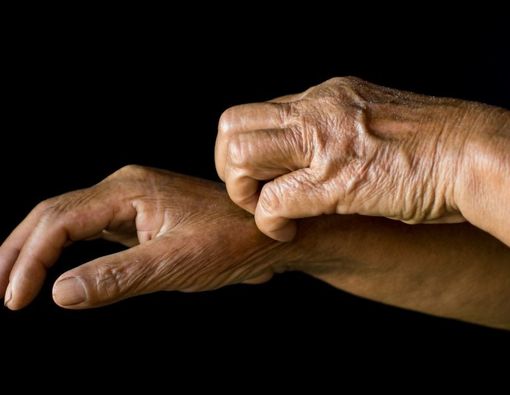 Fakta Penyakit Psoriasis Pada Orang Berkulit Gelap