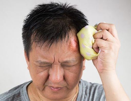 Kepala Anda Pernah Terbentur? Hati-Hati Alzheimer!