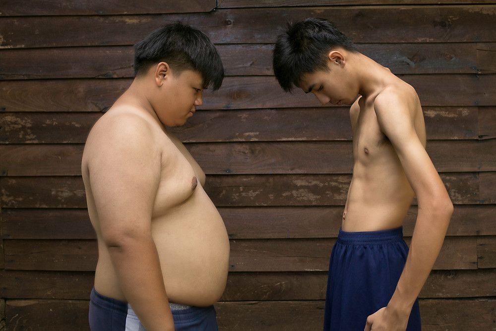 Punya Tubuh Kurus Sama Bahayanya dengan Obesitas?