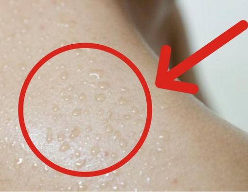 Ancaman Peningkatan Pertumbuhan Kuman pada Badan Berkeringat