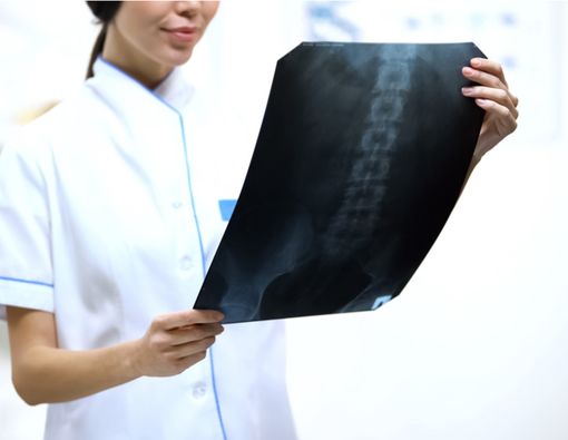 Hal yang Perlu Anda Tahu tentang Transplantasi Sumsum Tulang