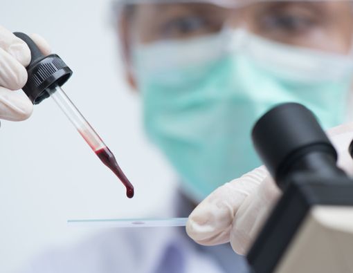 Diet Tepat untuk Orang dengan Kondisi Darah Kental