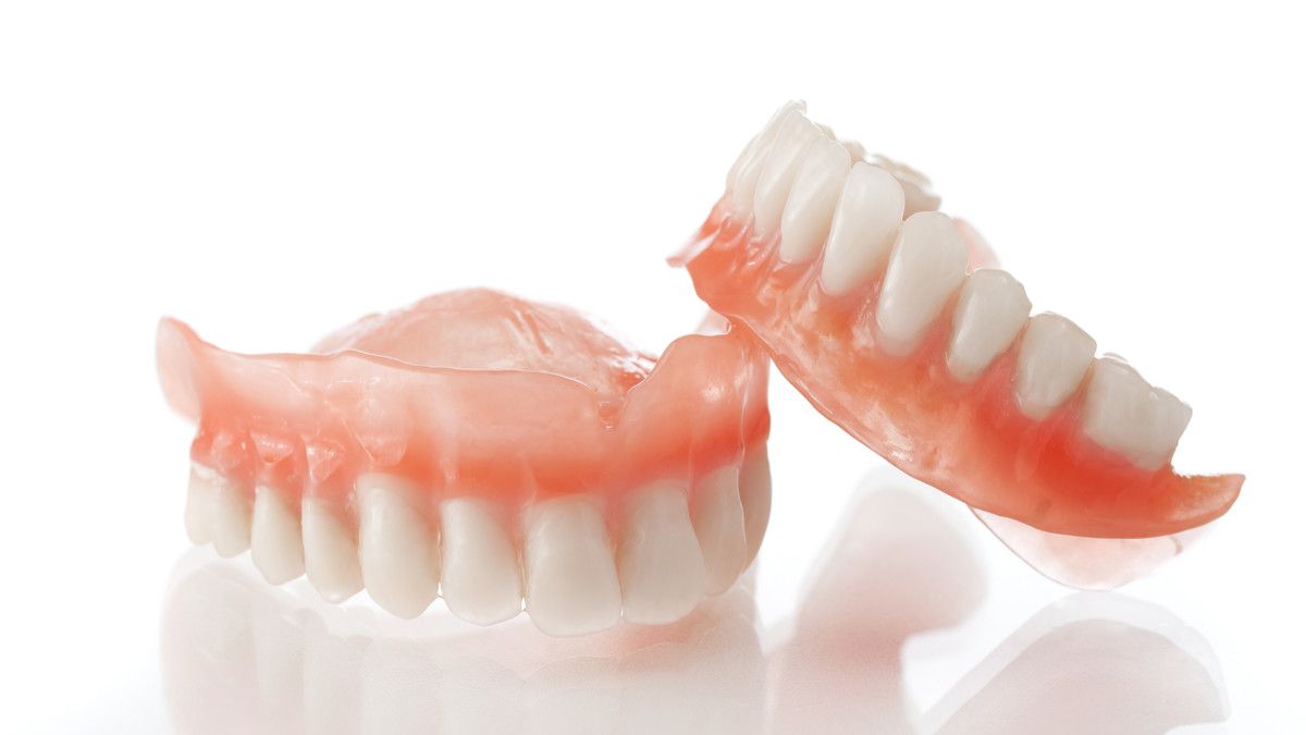 Amankah Pasang Gigi Palsu Tanpa Cabut Akar Gigi?