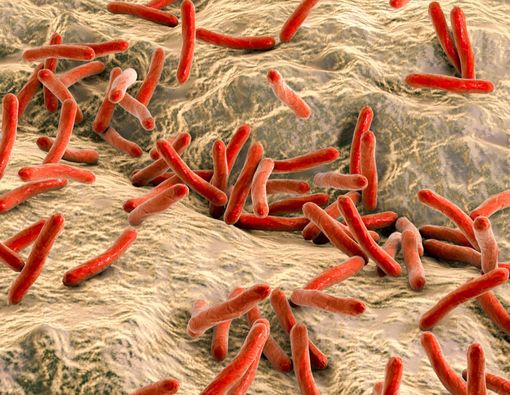 Mengenal Kusta, Penyakit Kulit yang Bisa Sebabkan Kebutaan