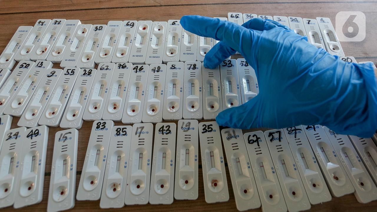 Pegawai Kemendikbud RI Jadi Suspect COVID-19, Ini Penjelasannya