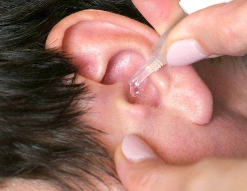 Jangan Sembarangan, Ini Cara Tepat Membersihkan Telinga