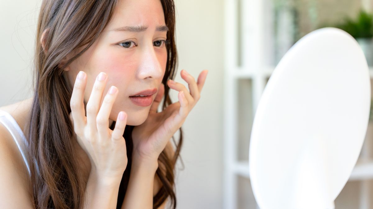 jatuh cinta bikin jerawatan