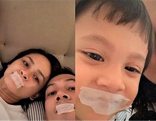 Fakta Buteyko Breathing, Tidur dengan Mulut Diplester ala Andien