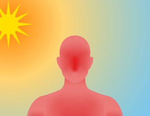 Benarkah Heatstroke Bisa Sebabkan Stroke pada Jemaah Haji?