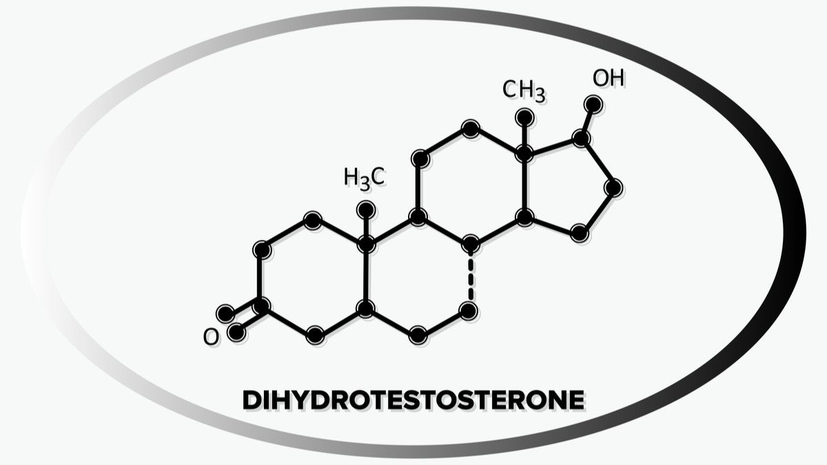 Ketahui Hubungan Dihidrotestosteron dan Kebotakan