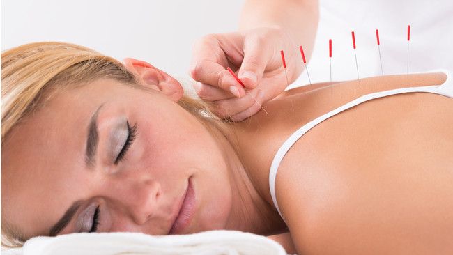 Benarkah Akupunktur Bisa Menurunkan Berat Badan?