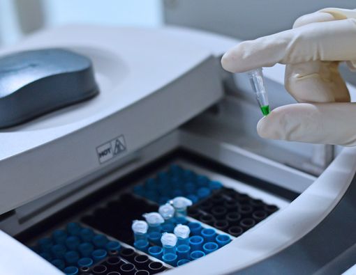 GYNPAD, Tes HPV dengan PCR untuk Deteksi Dini Kanker Serviks, Lebih Mudah dan Akurat!