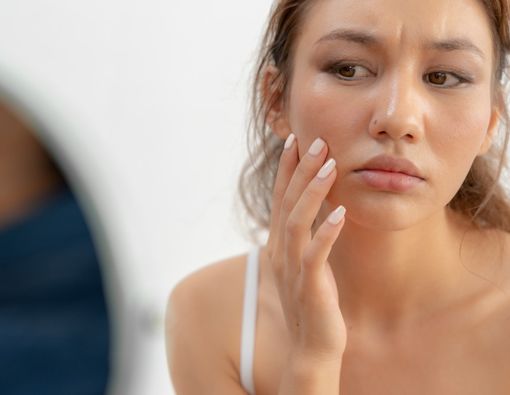 Bahaya Polusi Udara untuk Kesehatan Kulit