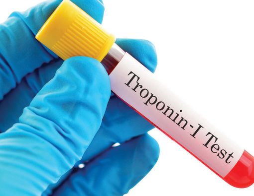 Cek Risiko Penyakit Jantung dengan Tes Troponin