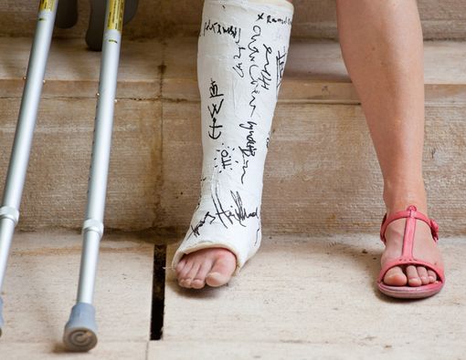 5 Cara Penanganan Patah Tulang pada Korban Kecelakaan Motor