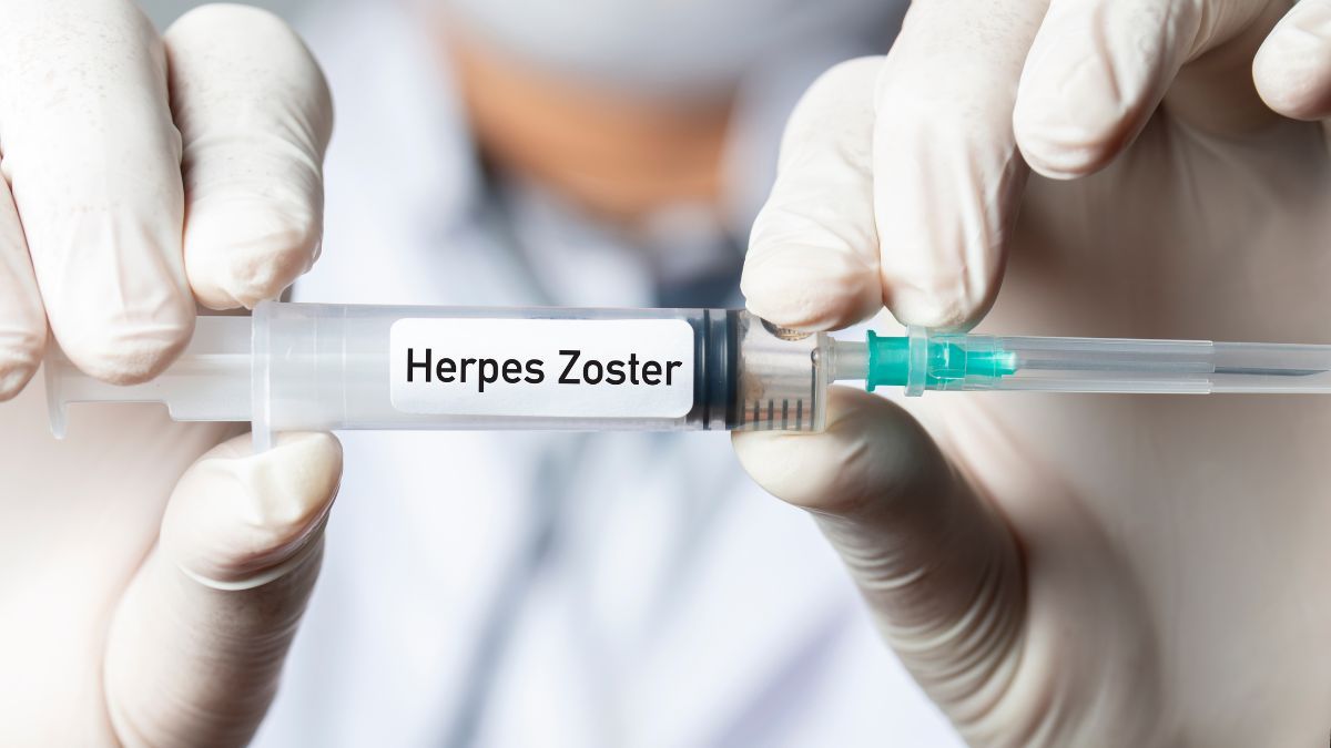 Mengenal Vaksin Herpes Zoster, Cara Kerja dan Efek Sampingnya