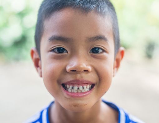 Penyebab Gigi Anak Hitam dan Cara Mengatasinya