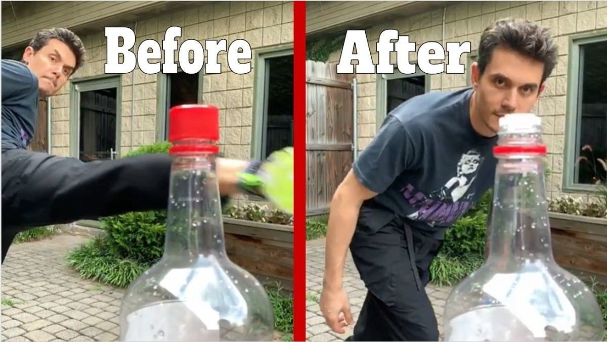 5 Cedera yang Mengintai Akibat Bottle Cap Challenge