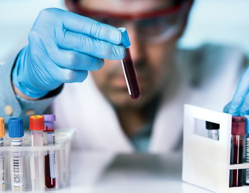 Trigliserida Tinggi, Apa Artinya bagi Kesehatan?