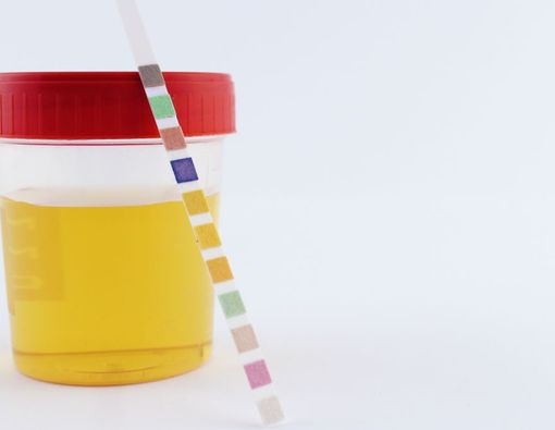 Beragam Arti Warna Urine yang Wajib Kamu Ketahui