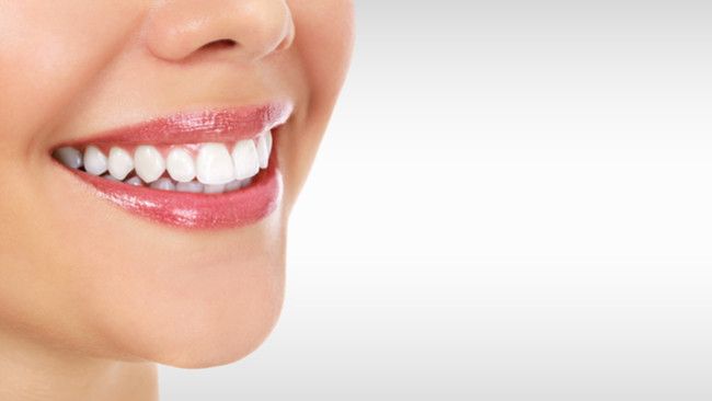 Fakta Memutihkan Gigi yang Perlu Anda Tahu