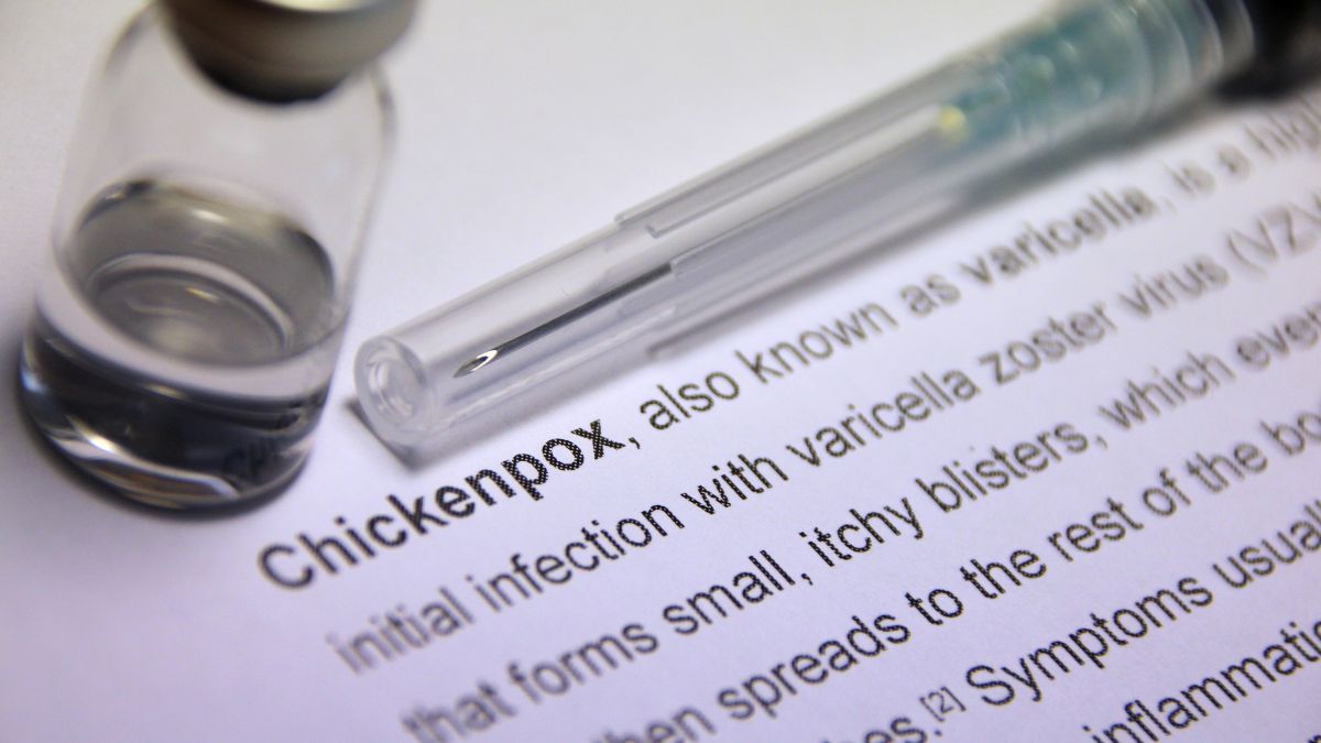 7 Jenis Obat Cacar Air Ampuh yang Bisa Kamu Temukan di Apotek