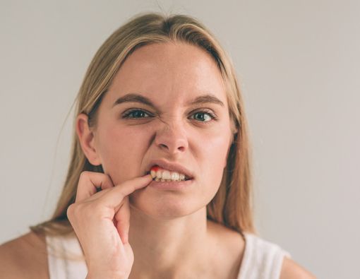 7 Penyakit Berbahaya Ini Harus Diwaspadai Saat Gusi Berdarah