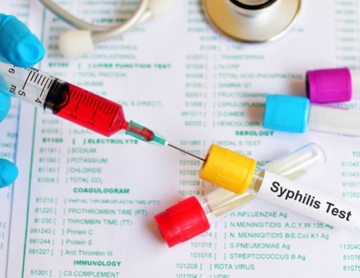 Mengenal Jenis dan Prosedur Pemeriksaan Sifilis