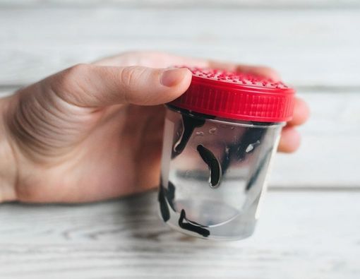 Minyak Lintah, Benarkah Ada Manfaatnya untuk Kesehatan?