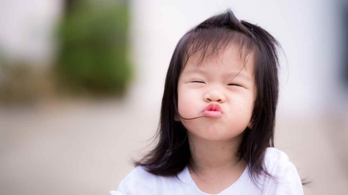 Ini 8 Faktor Penyebab Bibir Sumbing pada Bayi 