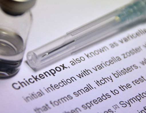 7 Jenis Obat Cacar Air Ampuh yang Bisa Kamu Temukan di Apotek