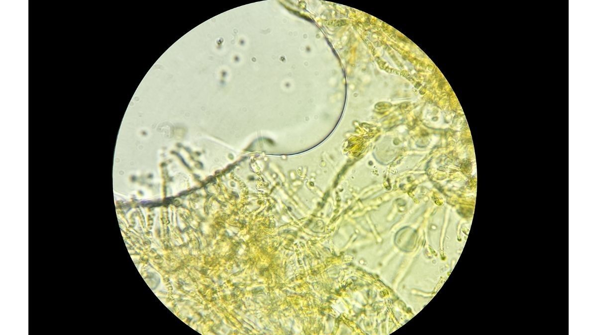 Kenali Infeksi Jamur Kuning yang Serang Pengidap COVID-19 di India