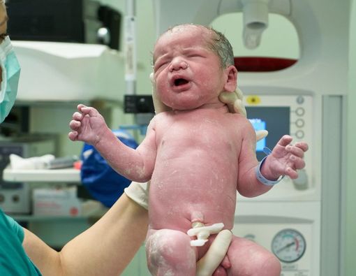 En Caul Birth, Saat Bayi Lahir Masih di dalam Kantong Ketuban