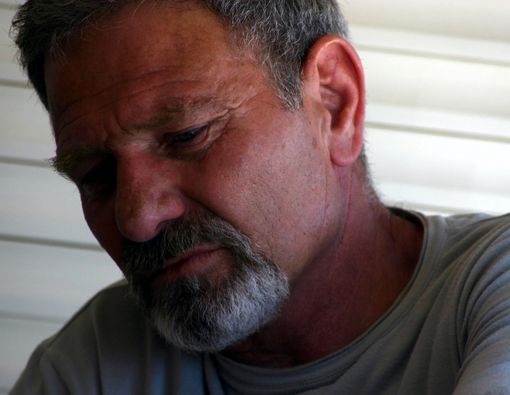 Tanda-Tanda Stroke yang Tidak Boleh Anda Abaikan