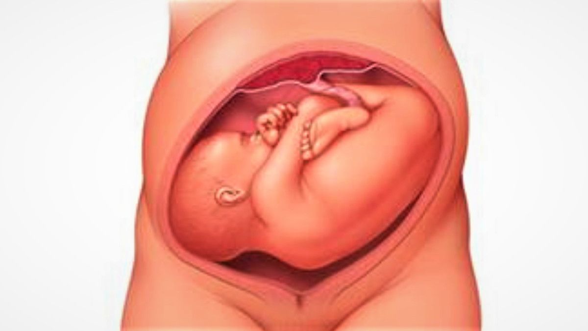 Posisi Bayi Melintang, Bisakah Berubah Jelang Kelahiran?