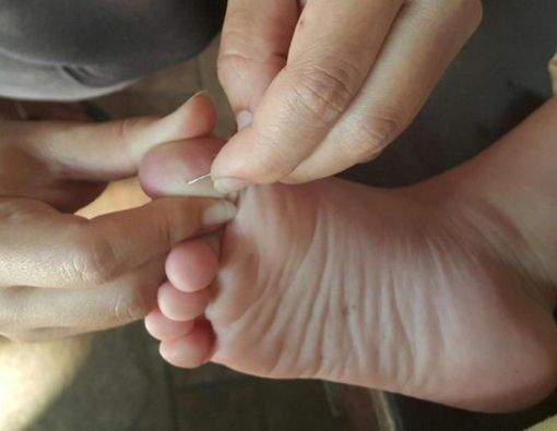 Kaki Kesusupan Dibiarkan Saja, Ini Bahayanya