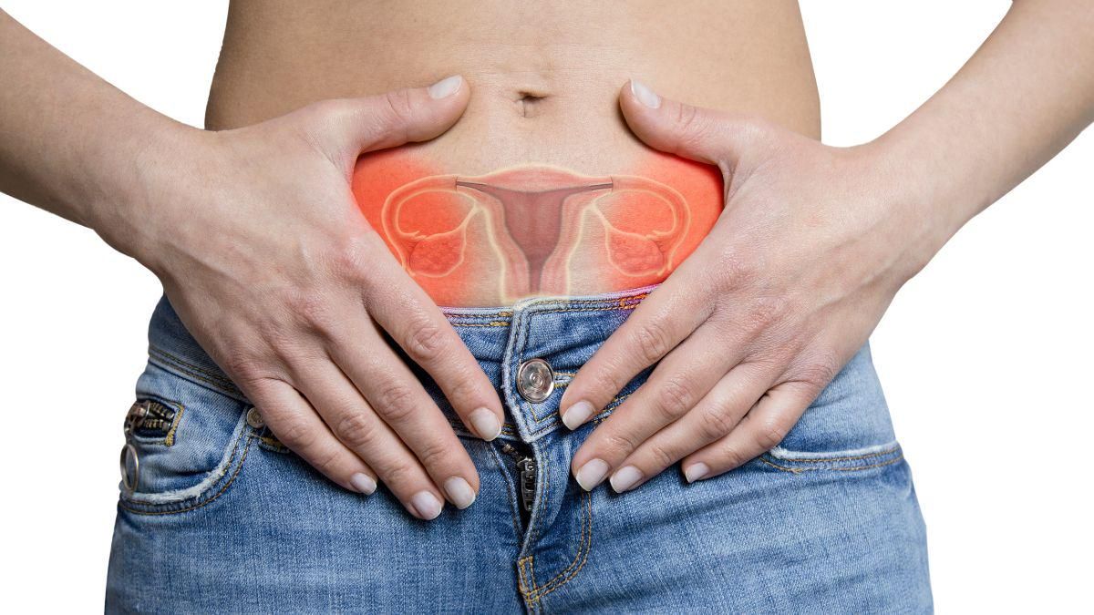 9  Penyebab Kista Ovarium pada Wanita
