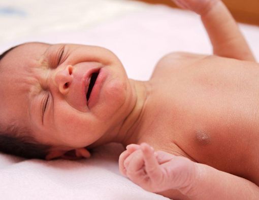 Kenali 5 Ciri-Ciri Anak Mengalami Penyakit Marasmus