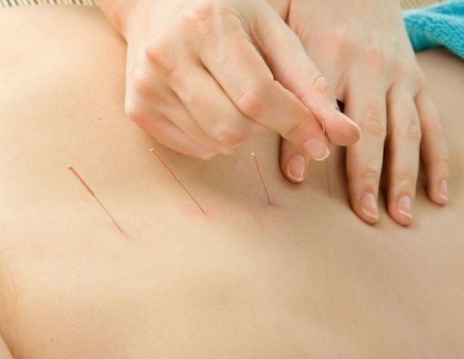 Cara Mengatasi Saraf Kejepit Saat Hamil