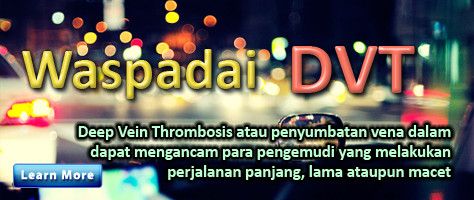 Hati-Hati Sumbatan Pembuluh Vena Dalam untuk Pemudik