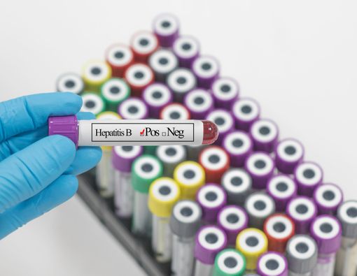 Bagaimana Cara Pemeriksaan Penyakit Hepatitis B?