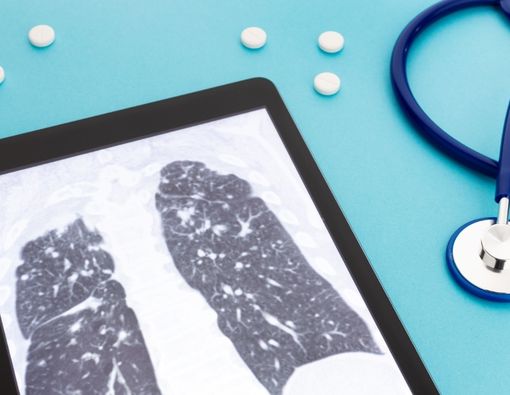 Perawatan untuk Penderita Penyakit Paru Restriktif