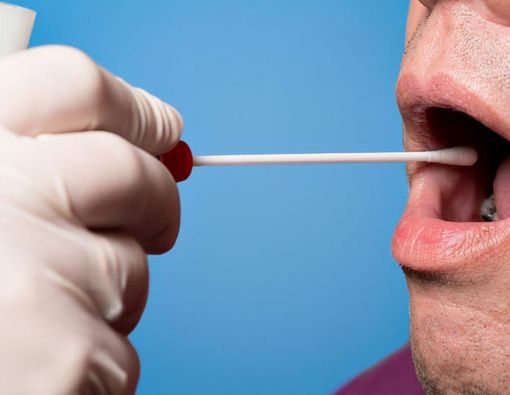 Awas, 5 Penyakit Ini Bisa Menyerang Kelenjar Ludah!