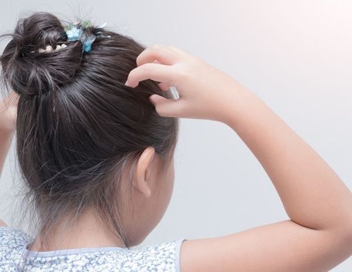 Ketombe pada Anak, Mungkinkah Karena Alergi?