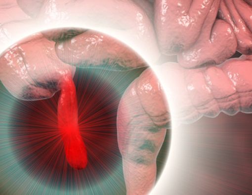 Fakta Mitos Usus Buntu