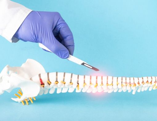 Mengenal Jenis-Jenis Operasi Tulang Belakang