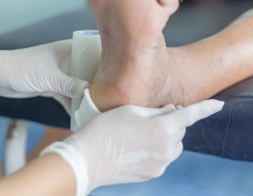 7 Masalah Kaki yang Sering Dialami Pengidap Diabetes